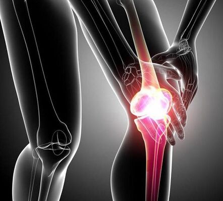 поражение коленного сустава при артрите и артрозе